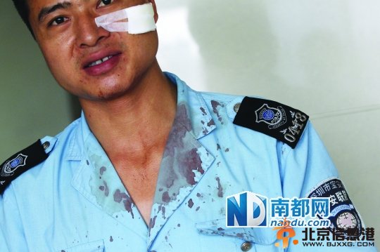 昨日，公明人民医院，一名被砖头砸中头部、制服上沾满血迹的联防队员。