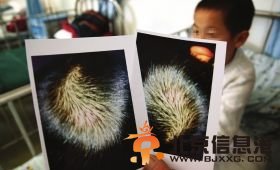 7岁男童因做作业不认真被托管所老师撞致脑震荡