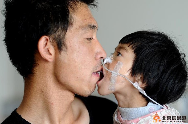 山西“喂食爸爸”照顾病女：有一线希望就不放弃