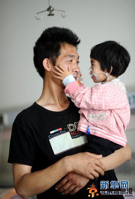 父亲嘴对嘴为患病女儿喂食 坚持500多天(图)