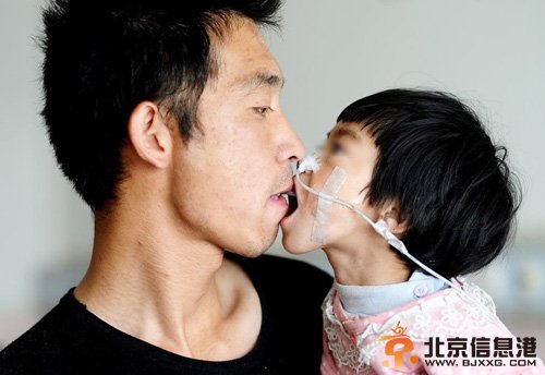 山西父亲嘴对嘴喂食女儿500天 照顾女儿成其他一生责任