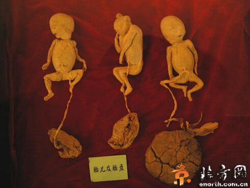组图：交警高速路上截获200多只人体胎盘