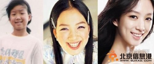 韩国女星假脸走天下 20大女星整容对比照判若两人