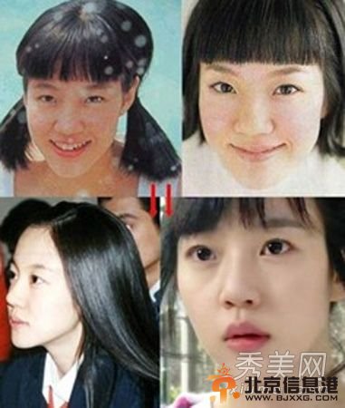 韩国女星假脸走天下 20大女星整容对比照判若两人
