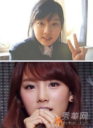 韩国女星假脸走天下 20大女星整容对比照判若两人