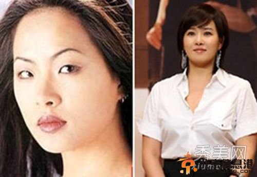 韩国女星假脸走天下 20大女星整容对比照判若两人