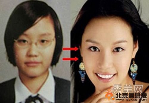 韩国女星假脸走天下 20大女星整容对比照判若两人