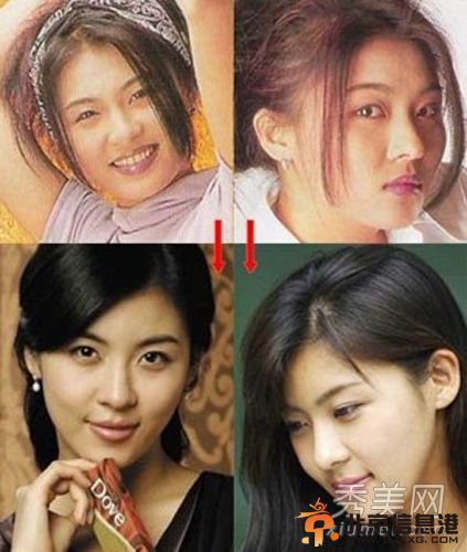 韩国女星假脸走天下 20大女星整容对比照判若两人