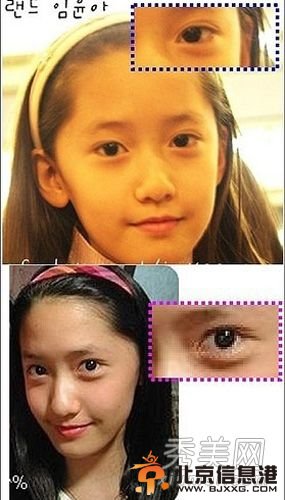 韩国女星假脸走天下 20大女星整容对比照判若两人