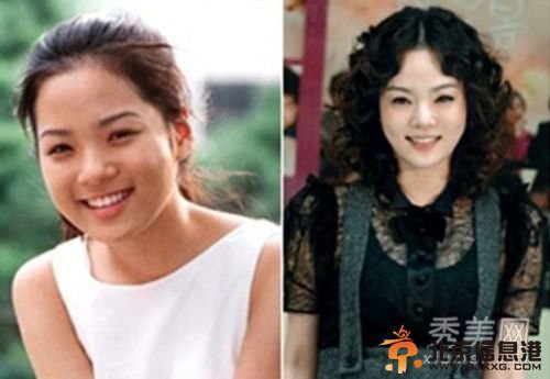韩国女星假脸走天下 20大女星整容对比照判若两人