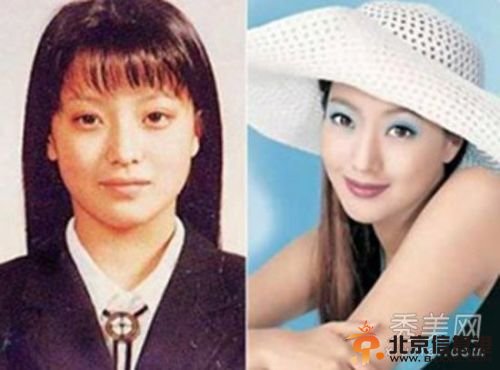 韩国女星假脸走天下 20大女星整容对比照判若两人