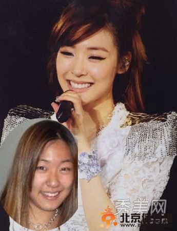 韩国女星假脸走天下 20大女星整容对比照判若两人