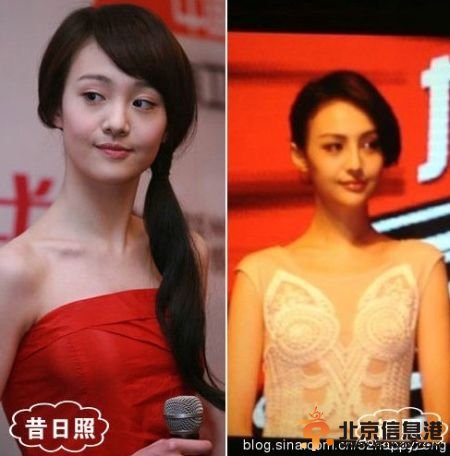 超女王梓高调宣布为事业整容 盘点公开承认整容的女星【图】