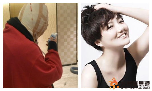 超女王梓高调宣布为事业整容 盘点公开承认整容的女星【图】