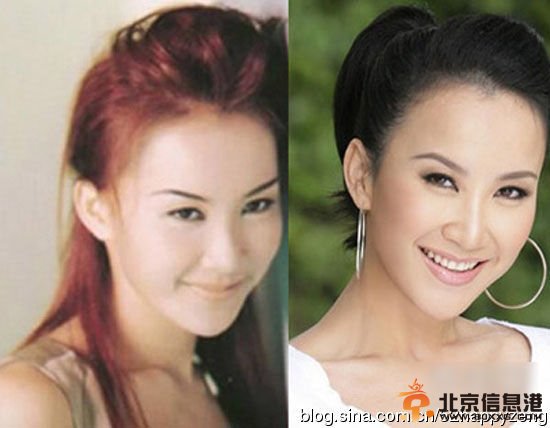 超女王梓高调宣布为事业整容 盘点公开承认整容的女星【图】