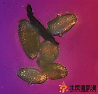 霾长什么样？北京雾霾放大1000倍图片引震惊