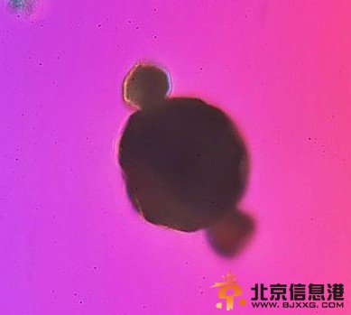 霾长什么样？<a href='http://www.bjxxg.cn/news/beijing/' target='_blank'><u>北京</u></a>雾霾放大1000倍图片引震惊