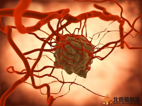 清华取得重大突破：人类有望饿死癌细胞