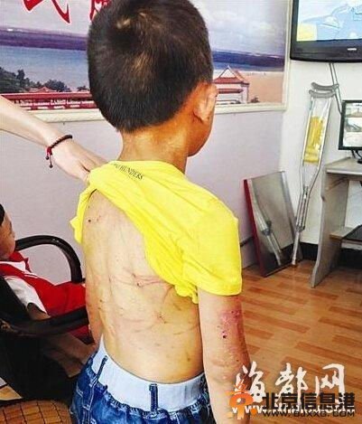福建9岁男童长期遭母虐待 被剪耳朵划脸(组图)