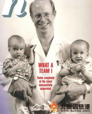 连体婴姐妹分离变美女走红 最美连体姐妹童年萌照惊宅男（组图）