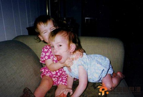 连体婴姐妹分离变美女走红 最美连体姐妹童年萌照惊宅男（组图）