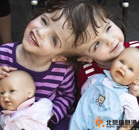 塔蒂安娜和克莉丝塔抱着小玩具玩，她们共用一个大脑，能体验到对方的<a href='http://www.bjxxg.cn/health/xinli/' target='_blank'><u>心理</u></a>感受