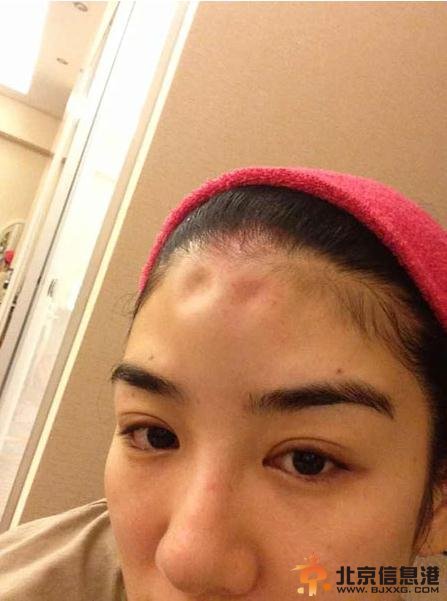 黄奕家暴被打照片曝光 老公怒斥其用玻尿酸伪造