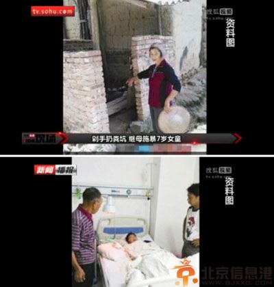继母剁下继女右手原因内幕图片 女孩手已接上情况不乐观