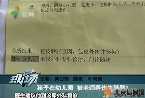 广州5岁男童疑遭老师用打火机烧生殖器 因弄坏物品