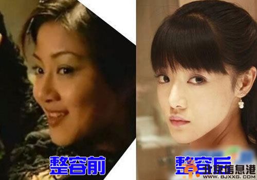 邓家佳整容前后照片对比 揭其个人资料及男友