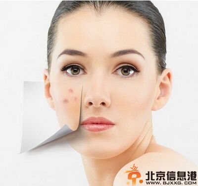 去痘痘的最好方法 告诉你如何祛痘痘小窍门