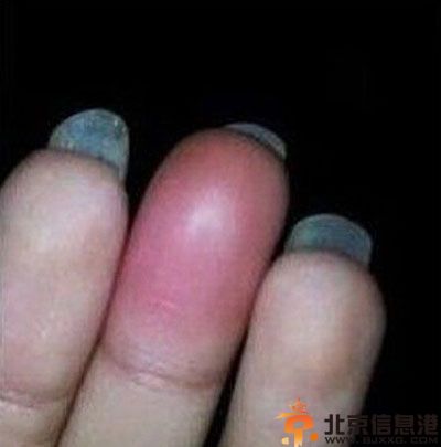 瞬间邪恶的内涵笑话 你抖了老二一下