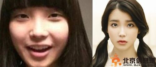 IU李智恩整容前后生活照片 节目中自爆成绩差到没有大学要