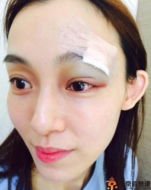 范玮琪怀孕了吗引关注 取消活动行程被疑怀孕