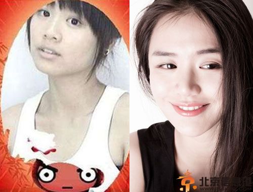 蒋雯丽外甥女马思纯整容前后对比照疑曝光 揭个人资料微博