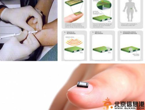芯片避孕有无副作用效果怎么样受关注 揭其避孕原理是什么