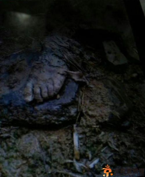 浙江安吉敬老院虐待老人事件 92岁林金凤老人小腿生蛆脱落