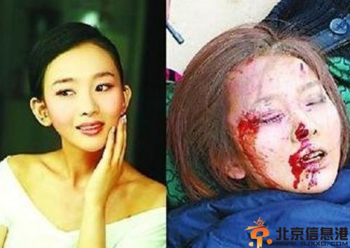 夏一瑶个人资料年龄照片车祸后近况 微博澄清与潘粤明车震事件