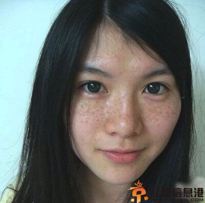 妊娠斑怎么消除 教你几个去除妊娠斑的小偏方