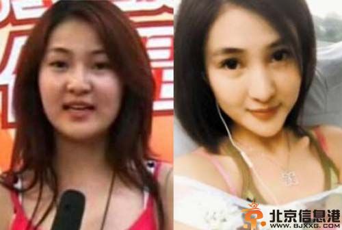 郭美美整容前后照片大集结 因赌球被抓传出丑闻