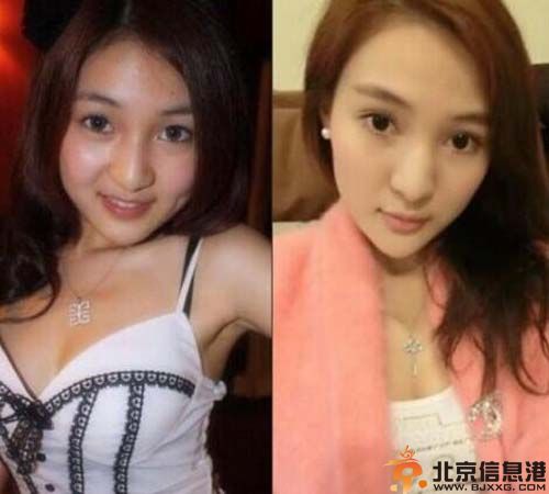 郭美美整容前后照片大集结 因赌球被抓传出丑闻