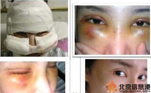 郭美美整容前后照片大集结 因赌球被抓传出丑闻