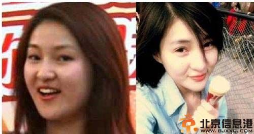 郭美美整容前后照片大集结 因赌球被抓传出丑闻
