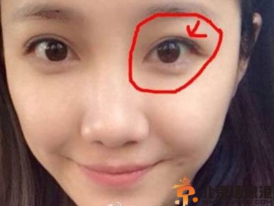 乌贼刘刘语熙微博原名刘航rachel 整容前后照片结婚对戒照片曝光