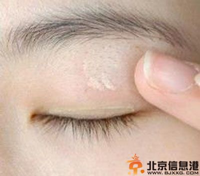 双眼皮贴教程图解 教你双眼皮贴怎么贴最自然