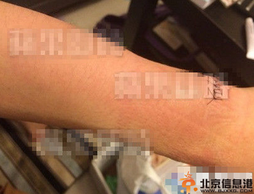 名模姚采颖三级片及老公是谁 疑割腕自杀曾卷入李宗瑞迷奸案