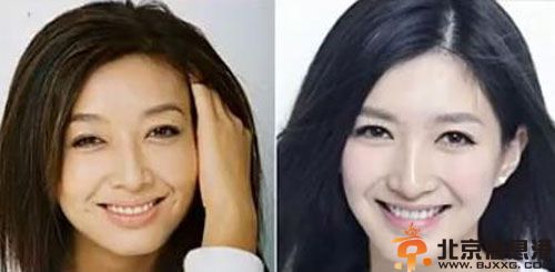 江疏影微博爆出整容前后图片 新剧胡歌江疏影变冤家