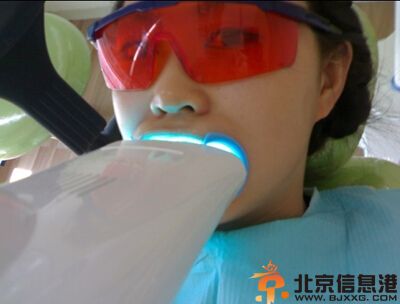 冷光牙齿美白优势有哪些 经济安全效果显著