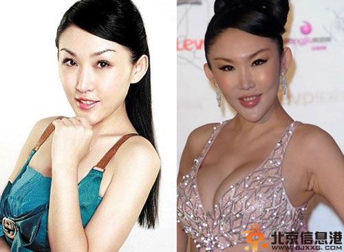 周诗雅整容前后对比照疑流出 胸围受关注内衣比基尼图片曝光