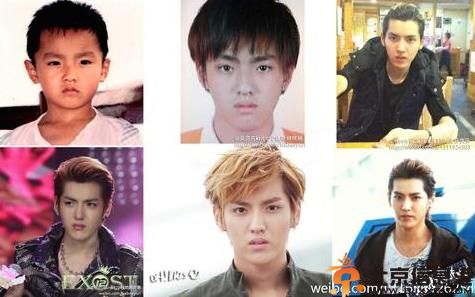 吴世勋整容前照片被爆 登上亚洲最丑的20个艺人名单